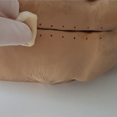 Let's Clean the Wound