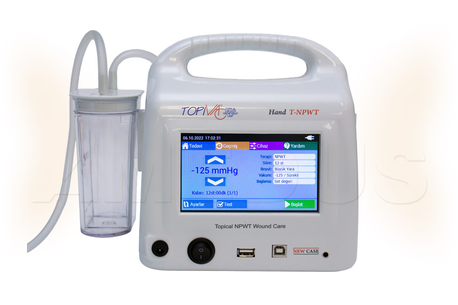 TopiVac Classic Digital Hand