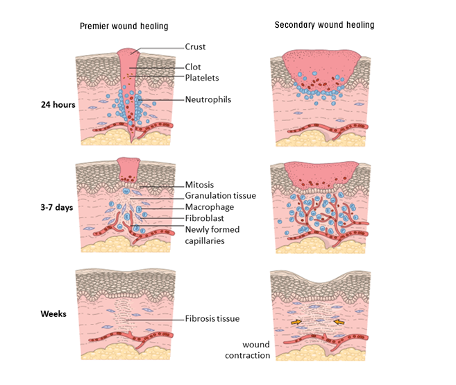 Wound Healing